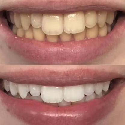 Sourire Parfait en 7 Jours – Pack Beauté Dentaire